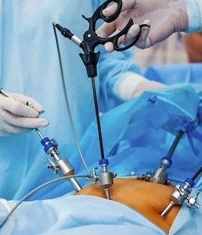laparoskopik-cerrahi