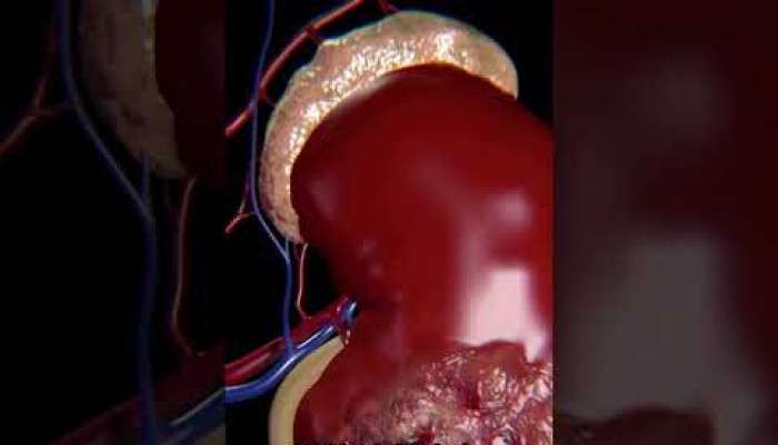 Sağlık,Hastalık,Tedavi,Üroloji,Ürolog,Uzman,hasta,hastane,ilaç,bilgi,ameliyat,hijyen,sağlıklı,doktor,mustafa kıraç,üroloji uzmanı,robotik cerrah,robotik cerrahi