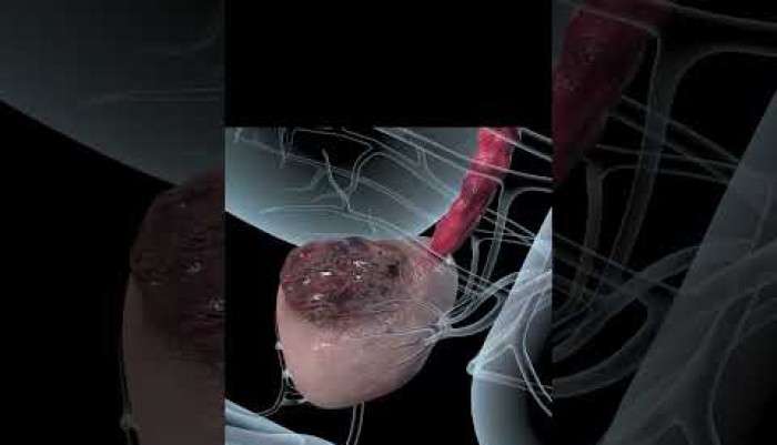 Sağlık,Hastalık,Tedavi,Üroloji,Ürolog,Uzman,hasta,hastane,ilaç,bilgi,ameliyat,hijyen,sağlıklı,doktor,mustafa kıraç,üroloji uzmanı,robotik cerrah,robotik cerrahi