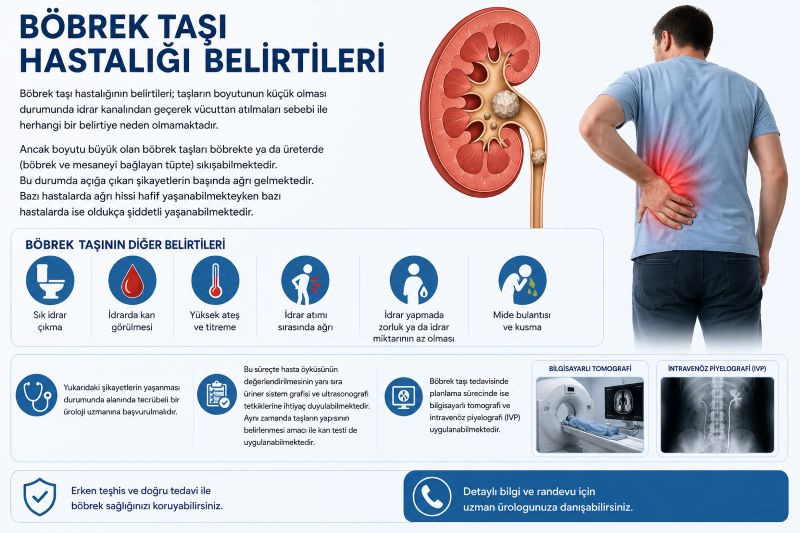 bobrek-tasi-hastaligi-belirtileri
