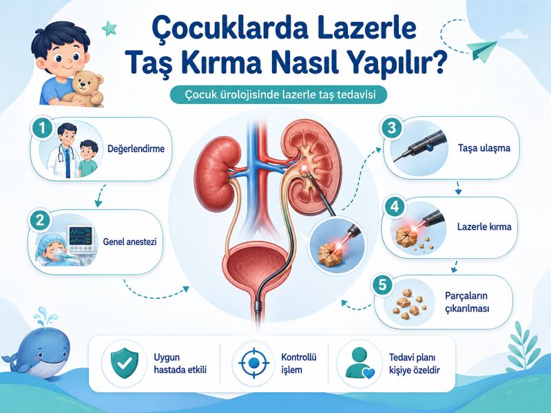 cocuklarda-lazerle-tas-kirma-nasil-yapilir