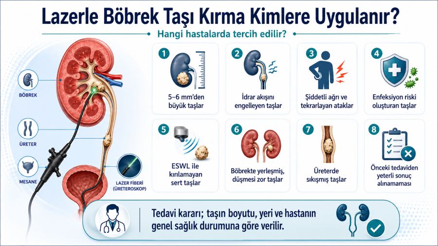 lazerle-bobrek-tasi-kirma-kimlere-uygulanir