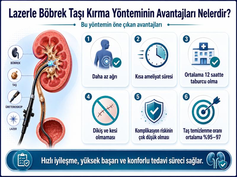 lazerle-bobrek-tasi-kirma-yonteminin-avantajlari-nelerdir