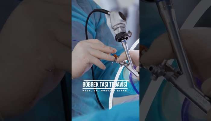 Sağlık,Hastalık,Tedavi,Üroloji,Ürolog,Uzman,hasta,hastane,ilaç,bilgi,ameliyat,hijyen,sağlıklı,doktor,mustafa kıraç,üroloji uzmanı,robotik cerrah,robotik cerrahi