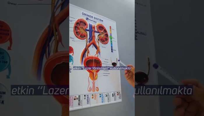 Sağlık,Hastalık,Tedavi,Üroloji,Ürolog,Uzman,hasta,hastane,ilaç,bilgi,ameliyat,hijyen,sağlıklı,doktor,mustafa kıraç,üroloji uzmanı,robotik cerrah,robotik cerrahi